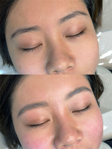 アイブロウ施術イメージ2